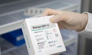 kaiyun：2024除尘设备行业市场需求、产业链、市场展望(图6)